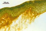 Sezione longitudinale radiale del tallo